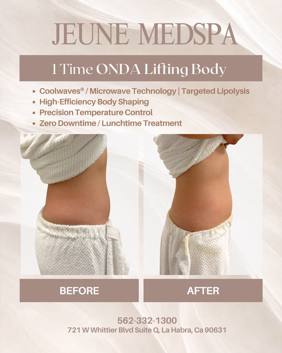 ONDA Body Lifting — 1 Session — before and after at Jeune Medspa La Habra