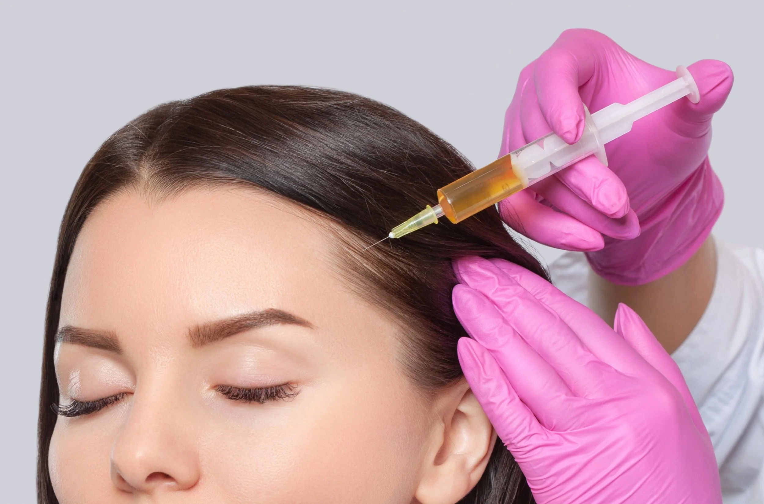 Hair rejuvenation PRP treatment at Jeune Medspa La Habra