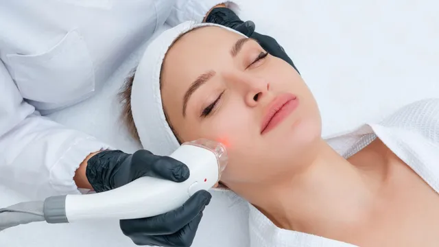 INOCELL fractional RF HIFU treatment at Jeune Medspa La Habra