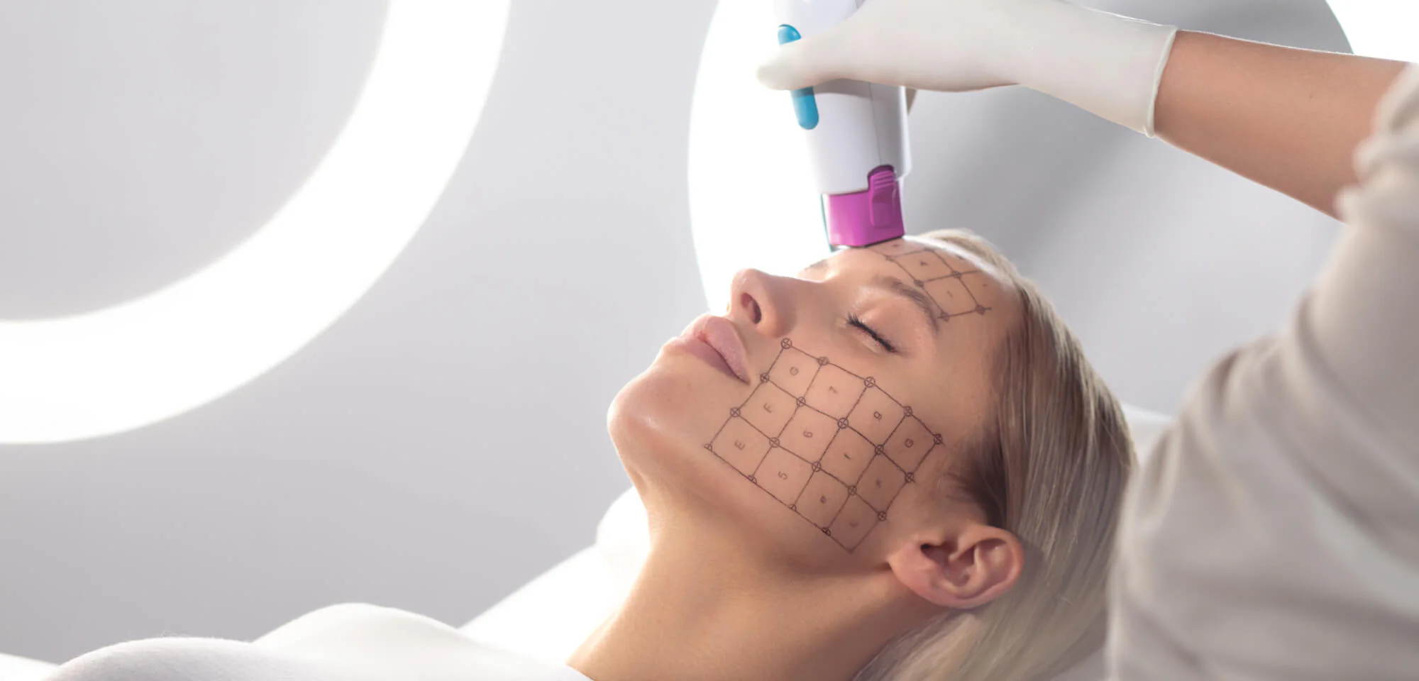 Thermage FLX radiofrequency skin tightening at Jeune Medspa